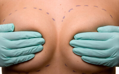Augmentation mammaire par lipofilling | Drs Kerfant et Trimaille | Brest