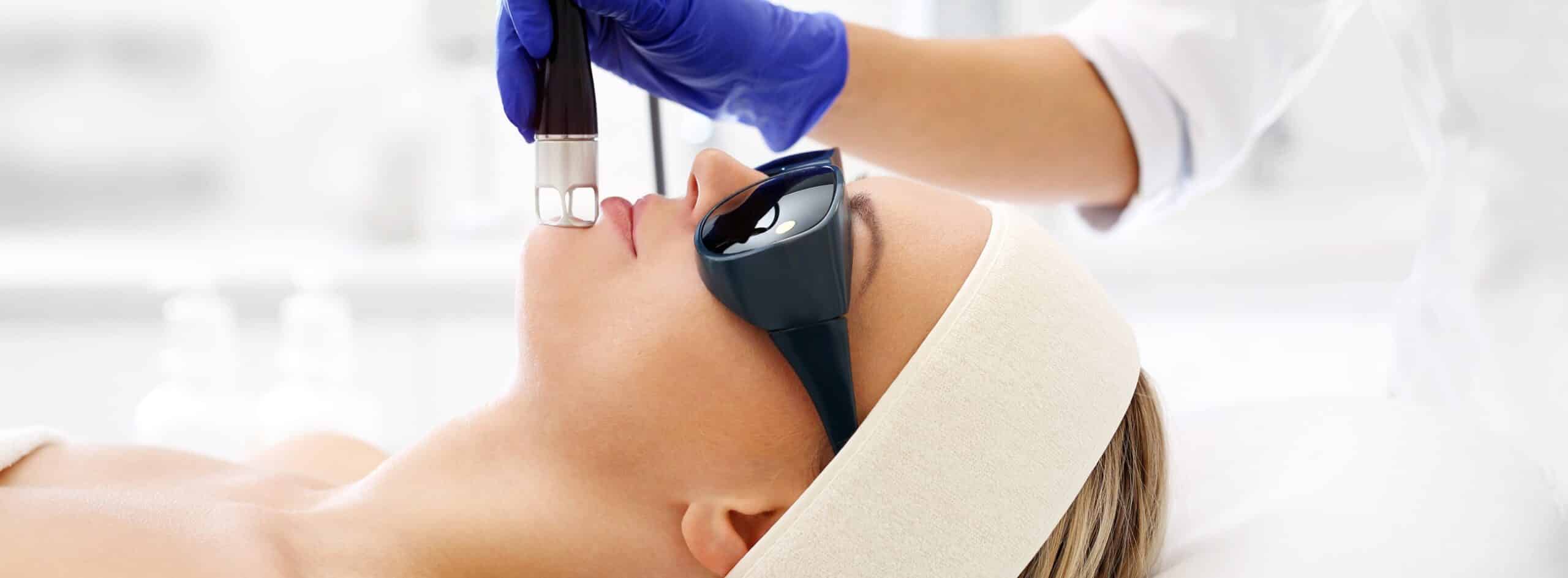 Epilation laser visage