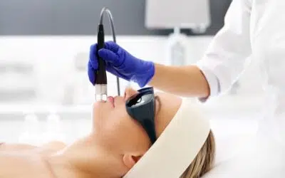 Epilation laser visage