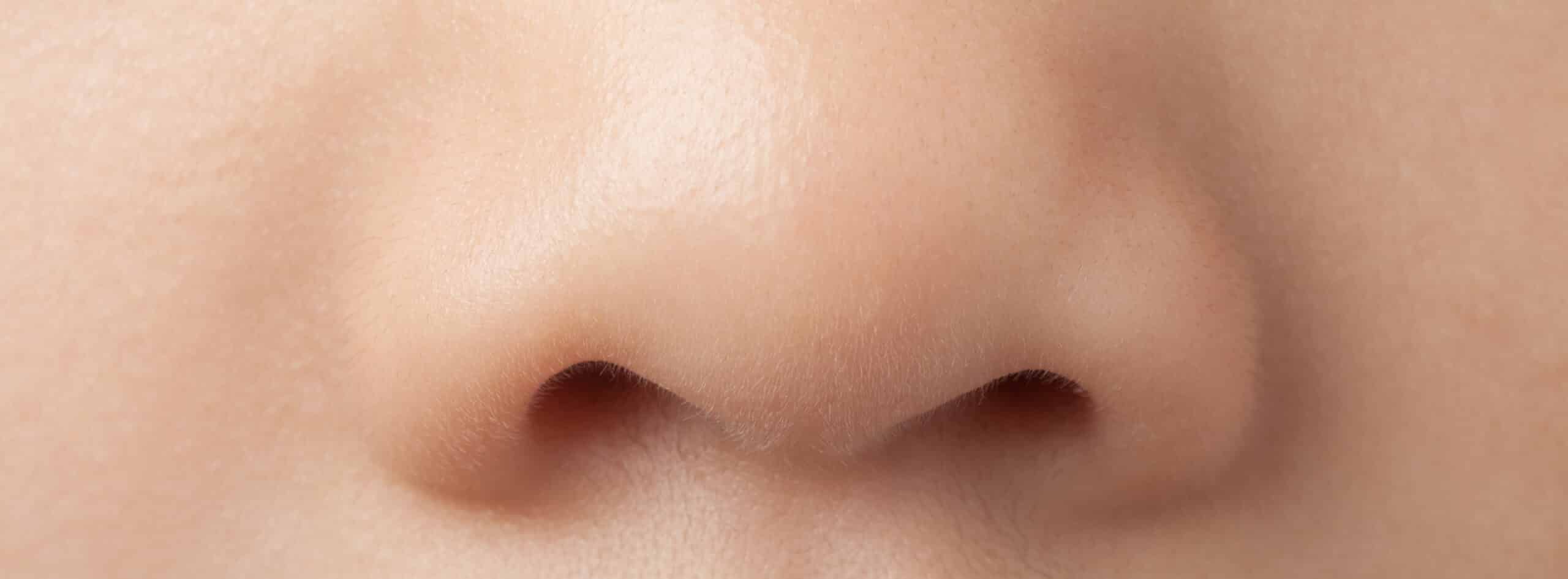 Rhinoplastie esthétique