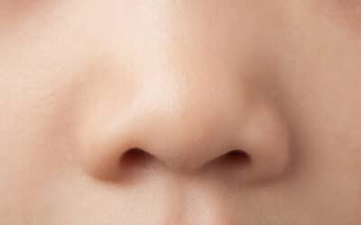 Rhinoplastie esthétique