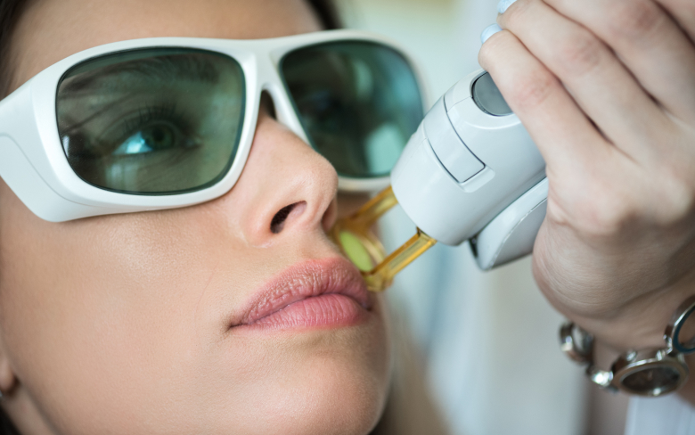 Epilation laser visage | Maison Kaer | Brest